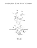 ARTHROPLASTY SYSTEM AND RELATED METHODS diagram and image