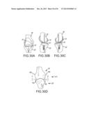 ARTHROPLASTY SYSTEM AND RELATED METHODS diagram and image