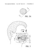 Cheek Path Airway diagram and image