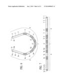 Cheek Path Airway diagram and image