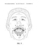 Cheek Path Airway diagram and image