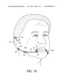 Cheek Path Airway diagram and image