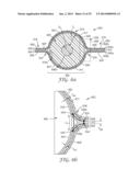 Shielded Electrical Cable diagram and image