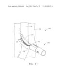 SURGICAL STAPLING DEVICE WITH A CURVED END EFFECTOR diagram and image