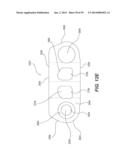 UNDERCARRIAGE ASSEMBLY WITH CARRIER SKID diagram and image