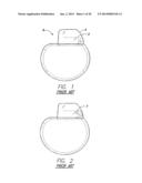 INVERTED E ANTENNA WITH PARALLEL PLATE CAPACITOR FORMED ALONG AN ARM OF     THE ANTENNA FOR USE WITH AN IMPLANTABLE MEDICAL DEVICE diagram and image