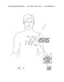 INVERTED E ANTENNA WITH PARALLEL PLATE CAPACITOR FORMED ALONG AN ARM OF     THE ANTENNA FOR USE WITH AN IMPLANTABLE MEDICAL DEVICE diagram and image