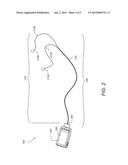 INTEGRATED EARBUD ANTENNA FOR RECEIVING TELEVISION BROADCASTS diagram and image