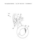 DEVICE AND METHOD TO REDUCE EAR WAX CLOGGING OF ACOUSTIC PORTS, HEARING     AID SEALING SYTEM, AND FEEDBACK REDUCTION SYSTEM diagram and image