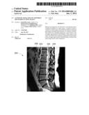 AUTOMATIC DETECTION OF VERTEBRAE BOUNDARIES IN SPINE IMAGES diagram and image
