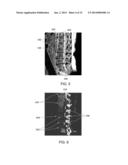 AUTOMATIC DETECTION OF VERTEBRAE BOUNDARIES IN SPINE IMAGES diagram and image