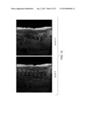 AUTOMATIC DETECTION OF VERTEBRAE BOUNDARIES IN SPINE IMAGES diagram and image