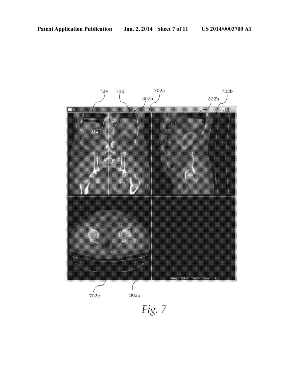 Fused-Image Visualization for Surgery Evaluation - diagram, schematic, and image 08