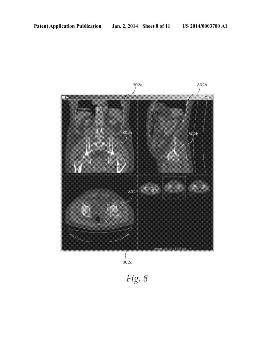 Fused-Image Visualization for Surgery Evaluation - diagram, schematic, and image 09