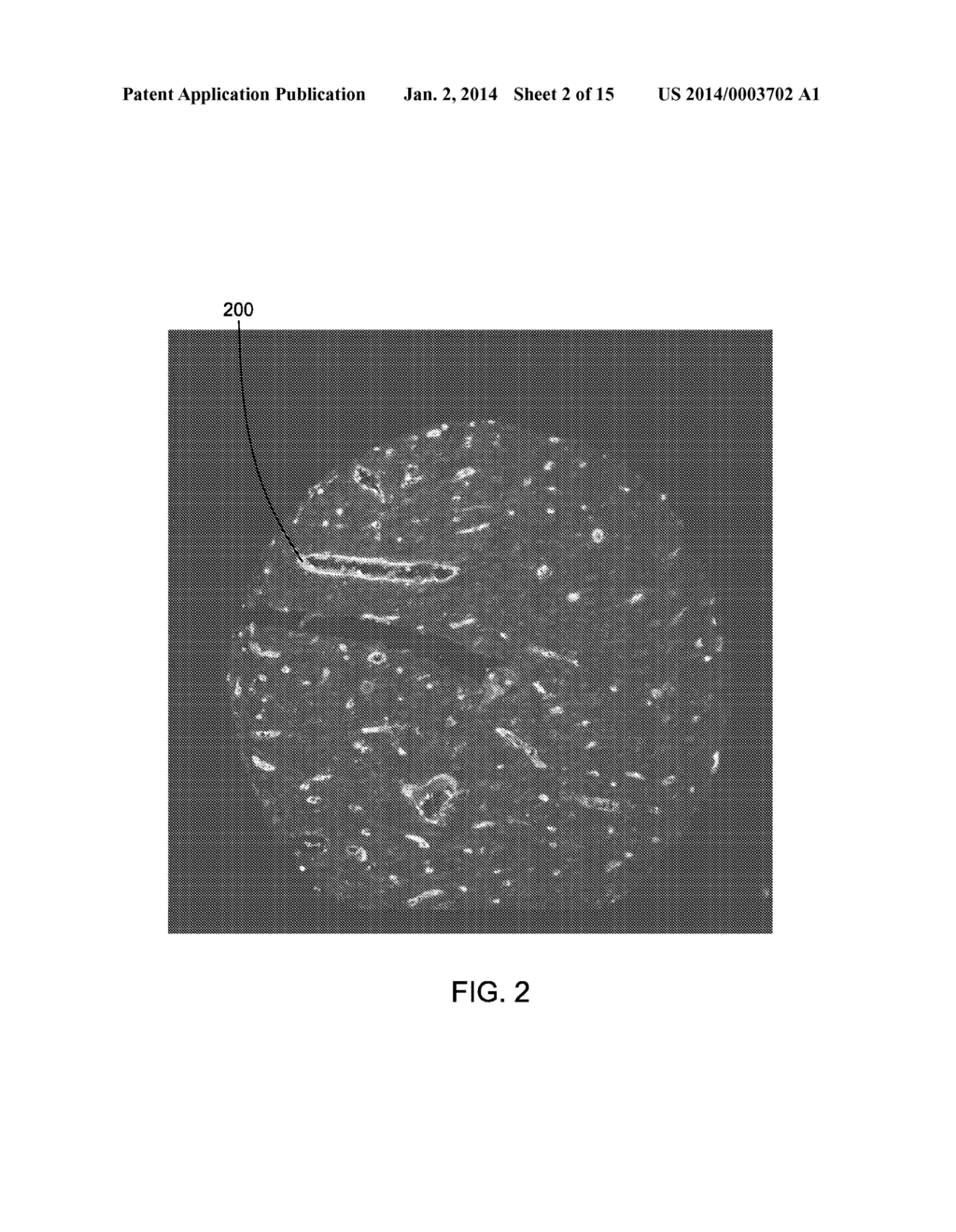 DETERMINATION OF SPATIAL PROXIMITY BETWEEN FEATURES OF INTEREST IN     BIOLOGICAL TISSUE - diagram, schematic, and image 03