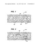 LOCAL VASCULAR DELIVERY OF TRICHOSTATIN A ALONE OR IN COMBINATION WITH     SIROLIMUS TO PREVENT RESTENOSIS FOLLOWING VASCULAR INJURY diagram and image