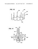 LOCAL VASCULAR DELIVERY OF TRICHOSTATIN A ALONE OR IN COMBINATION WITH     SIROLIMUS TO PREVENT RESTENOSIS FOLLOWING VASCULAR INJURY diagram and image