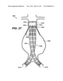 LOCAL VASCULAR DELIVERY OF TRICHOSTATIN A ALONE OR IN COMBINATION WITH     SIROLIMUS TO PREVENT RESTENOSIS FOLLOWING VASCULAR INJURY diagram and image