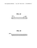 LOCAL VASCULAR DELIVERY OF TRICHOSTATIN A ALONE OR IN COMBINATION WITH     SIROLIMUS TO PREVENT RESTENOSIS FOLLOWING VASCULAR INJURY diagram and image