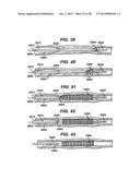 LOCAL VASCULAR DELIVERY OF TRICHOSTATIN A ALONE OR IN COMBINATION WITH     SIROLIMUS TO PREVENT RESTENOSIS FOLLOWING VASCULAR INJURY diagram and image