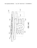 SURGICAL VISUALIZATION SYSTEM WITH CAMERA TRACKING diagram and image