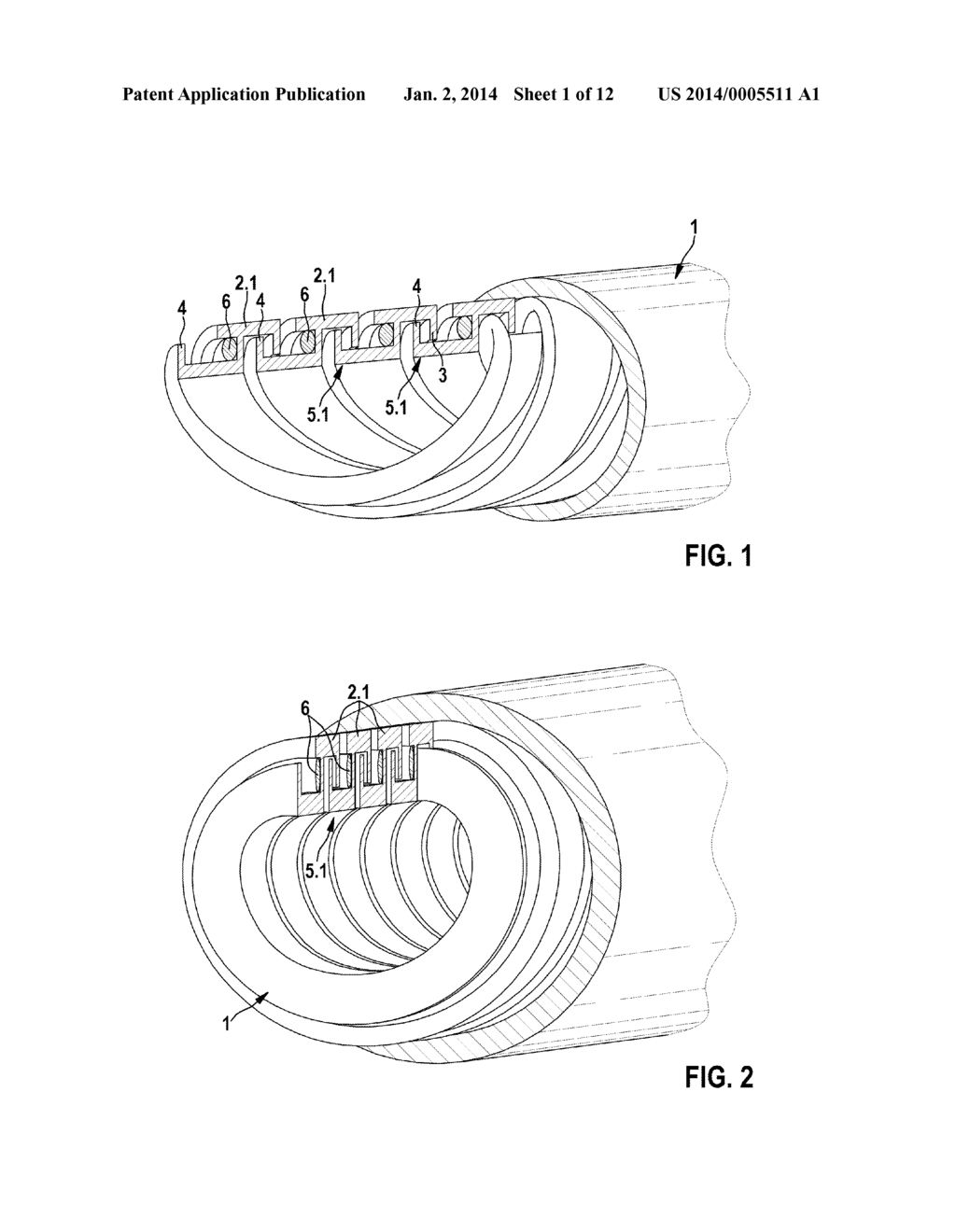 Implantable Medical Tube Arrangement - diagram, schematic, and image 02