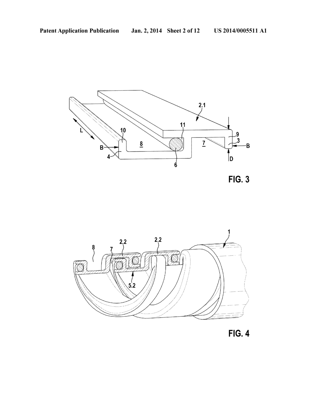 Implantable Medical Tube Arrangement - diagram, schematic, and image 03