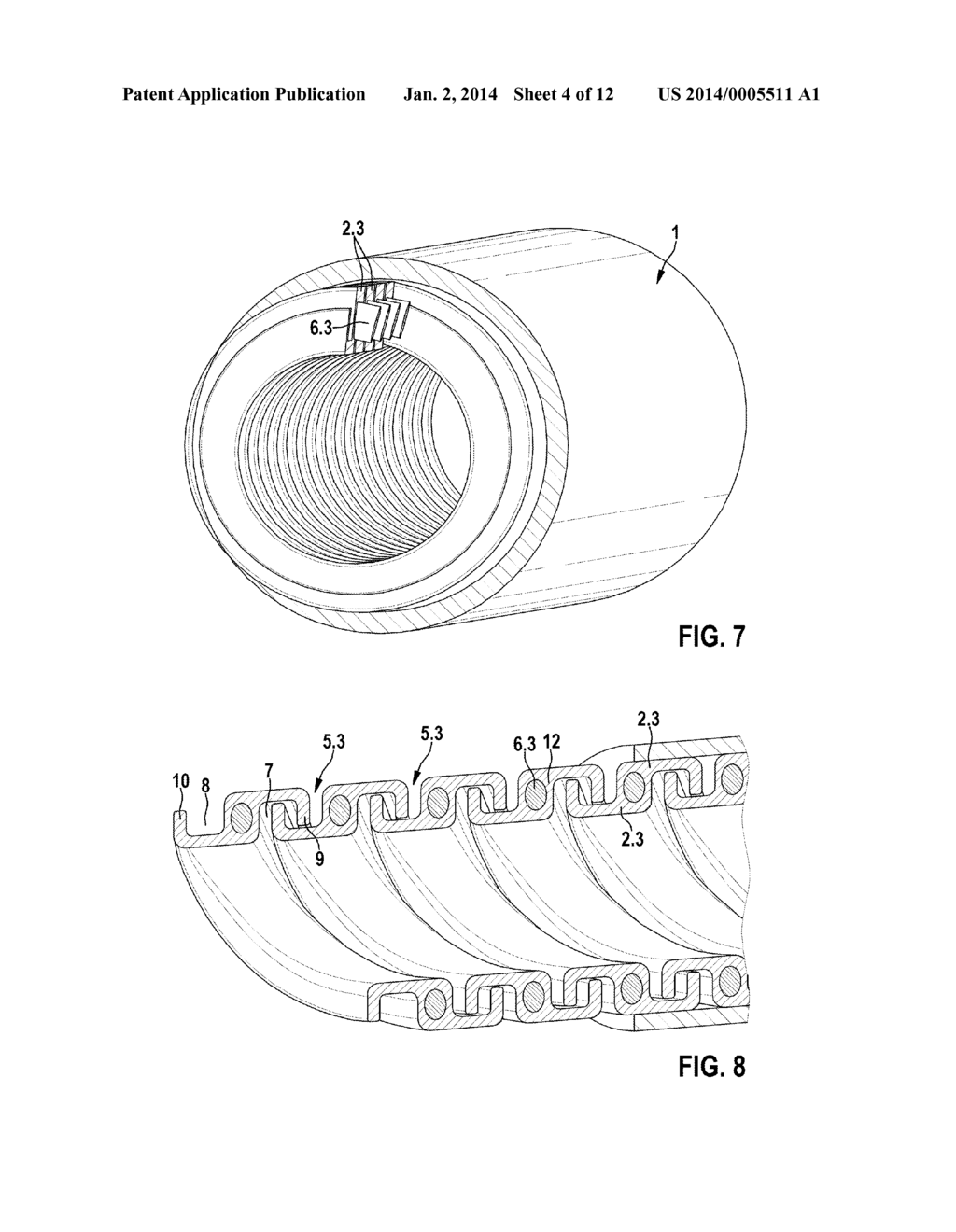 Implantable Medical Tube Arrangement - diagram, schematic, and image 05