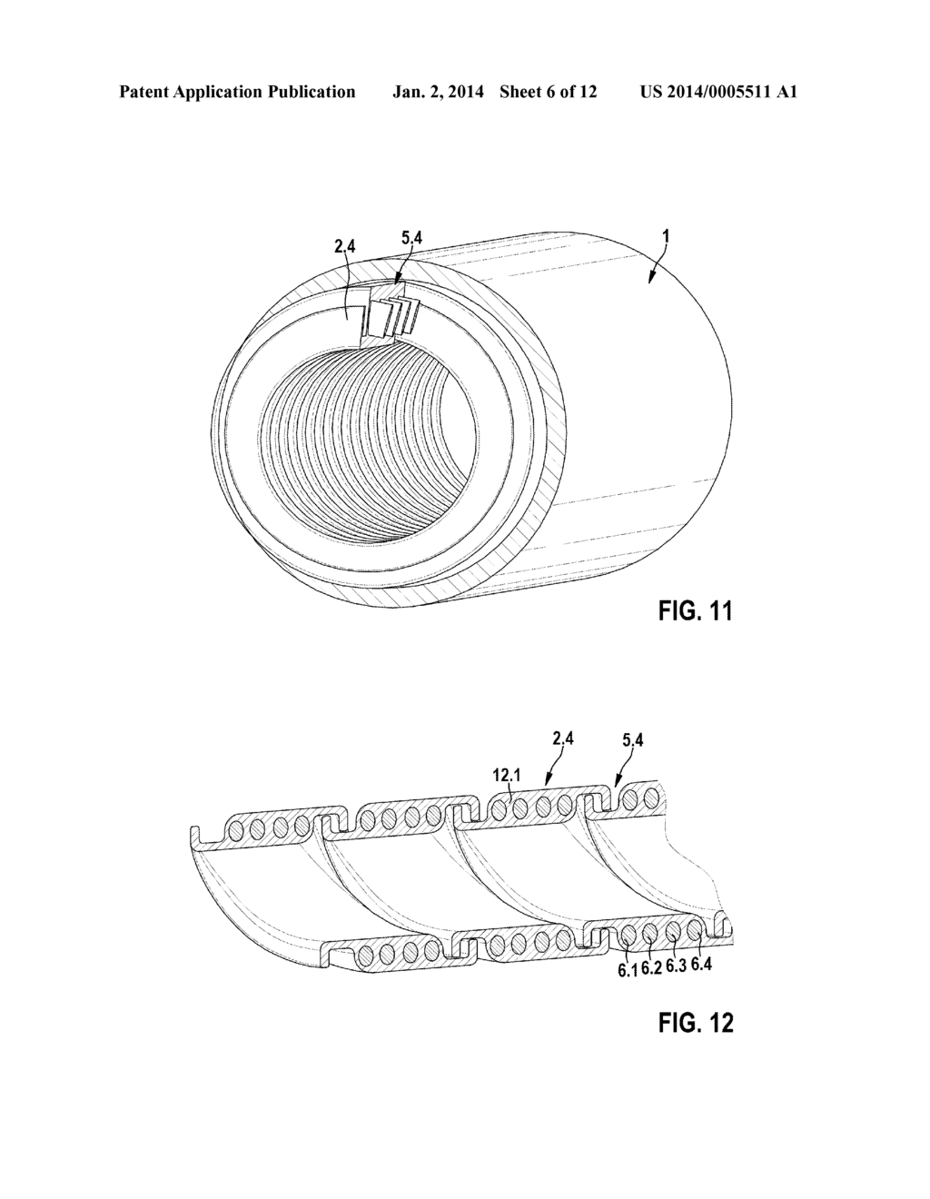 Implantable Medical Tube Arrangement - diagram, schematic, and image 07