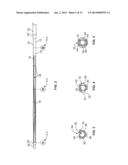 IVC FILTER CATHETER WITH IMAGING MODALITY diagram and image