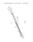 IVC FILTER CATHETER WITH IMAGING MODALITY diagram and image