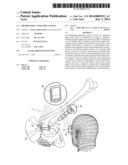 ORTHOPAEDIC NAVIGATION SYSTEM diagram and image