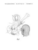 ORTHOPAEDIC NAVIGATION SYSTEM diagram and image