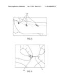 Device and Method for Injecting Pulsed Steam Into a Human or Animal Vessel     E.G. a Vein diagram and image