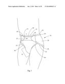 Disposable Absorbent Insert for Two-Piece Wearable Absorbent Article diagram and image