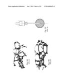 Bone Cement System For Bone Augmentation diagram and image