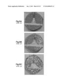 Bone Cement System For Bone Augmentation diagram and image