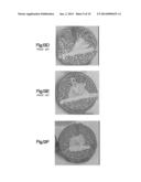 Bone Cement System For Bone Augmentation diagram and image