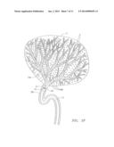 Method of Treating Tissue with Radio Frequency Vascular Electrode Array diagram and image