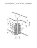 METHODS OF USE OF A CLIP APPLIER diagram and image