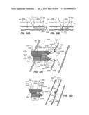 METHODS OF USE OF A CLIP APPLIER diagram and image