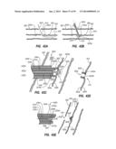 METHODS OF USE OF A CLIP APPLIER diagram and image