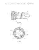 VARIABLE ANGLE BONE FIXATION DEVICE diagram and image