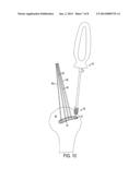 Tissue Repair Suture Plates and Methods of Use diagram and image