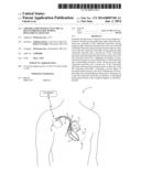 CRITERIA FOR OPTIMAL ELECTRICAL RESYNCHRONIZATION DURING BIVENTRICULAR     PACING diagram and image