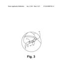 CRITERIA FOR OPTIMAL ELECTRICAL RESYNCHRONIZATION DURING BIVENTRICULAR     PACING diagram and image