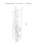 FLUID SUPPLY CONTROL FOR PATIENT SUPPORT SURFACE diagram and image