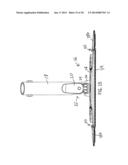 Cleaning Device Having A Variable Size And Shape Head diagram and image