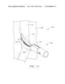 SURGICAL STAPLING DEVICE WITH A CURVED END EFFECTOR diagram and image