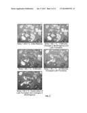 FORM OF HEXYL-5-AMINOLEVULINATE HYDROCHLORIDE AND METHODS OF USING THE     SAME diagram and image